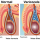 Illustration for article titled Obat Varikokel Pada Testis